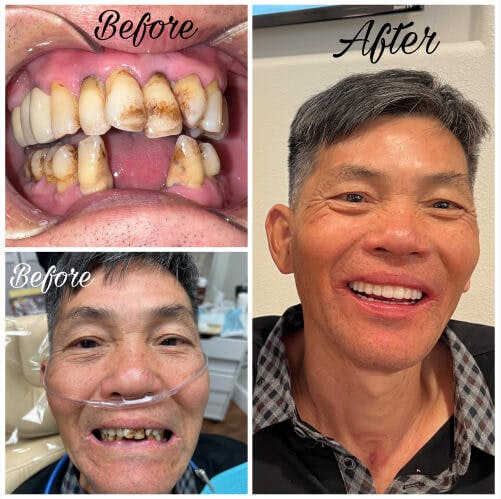 ProSmiles OC | Dental Lab, Emergency Treatment and Oral Cancer Screening