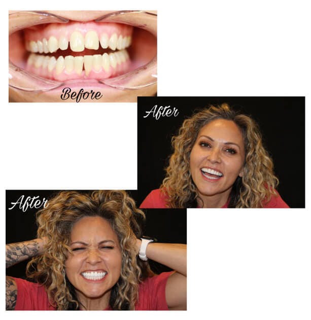 ProSmiles OC | Oral Exams, Intraoral Camera and Fluoride Treatment