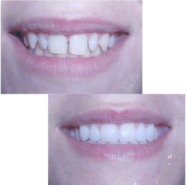 ProSmiles OC | ZOOM Whitening, Emergency Treatment and Implant Dentistry