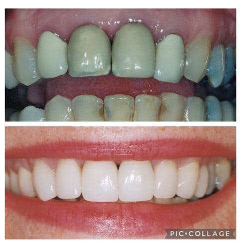 ProSmiles OC | Intraoral Camera, Full Mouth Reconstruction and Oral Cancer Screening