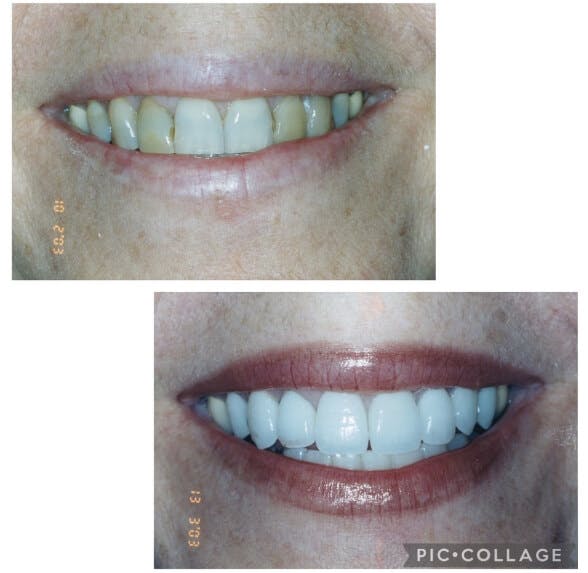 ProSmiles OC | Dental Lab, Intraoral Camera and Night Guards