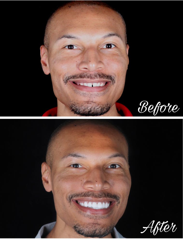 ProSmiles OC | Digital Radiography, Emergency Treatment and Oral Cancer Screening