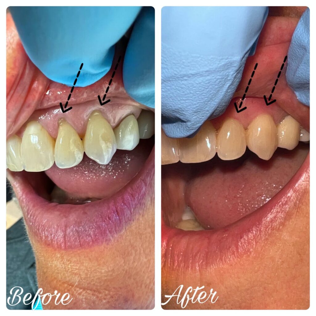 ProSmiles OC | Dental Cleanings, Sports Mouthguards and Dental Lab