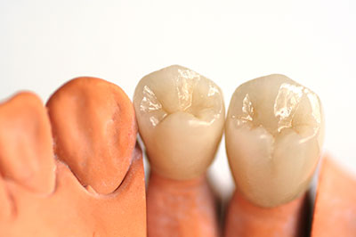ProSmiles OC | CEREC, Dental Lab and Invisalign reg 