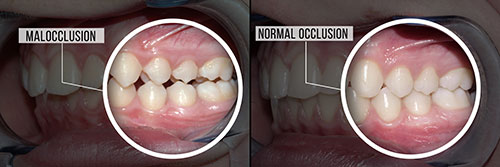 ProSmiles OC | Night Guards, Intraoral Camera and ZOOM  Whitening