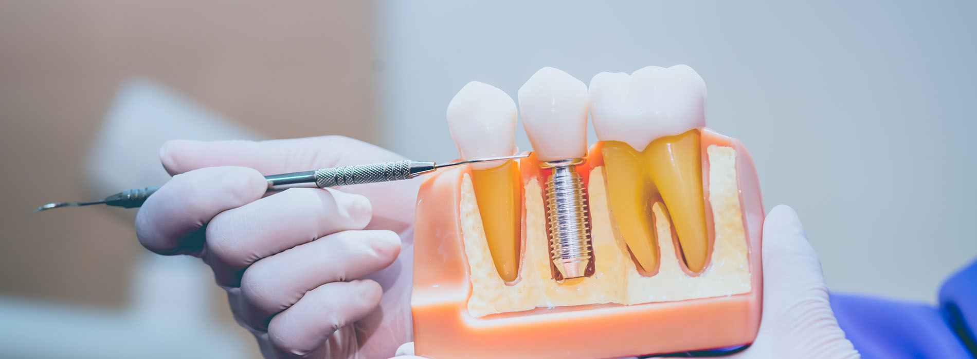 ProSmiles OC | Dentures, Ceramic Crowns and Invisalign reg